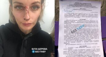 Зламали ніс, вибили зуби: неповнолітні у Білій Церкві неадекватно відрегували на зауваження молодої мами